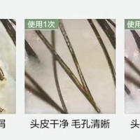 头皮控油精华：让你的头发告别油腻，清爽一整天!