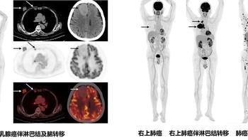 关于湖北人看病的干货分享：医保转院及异地就医备案方法