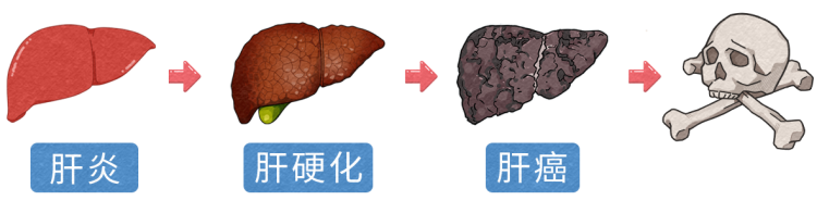 眼睛若發生這2個變化或是肝臟求救信號別拖到肝癌才發現