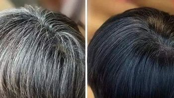 如何改善白发变黑发？12大头发养护技巧汇总，必看！