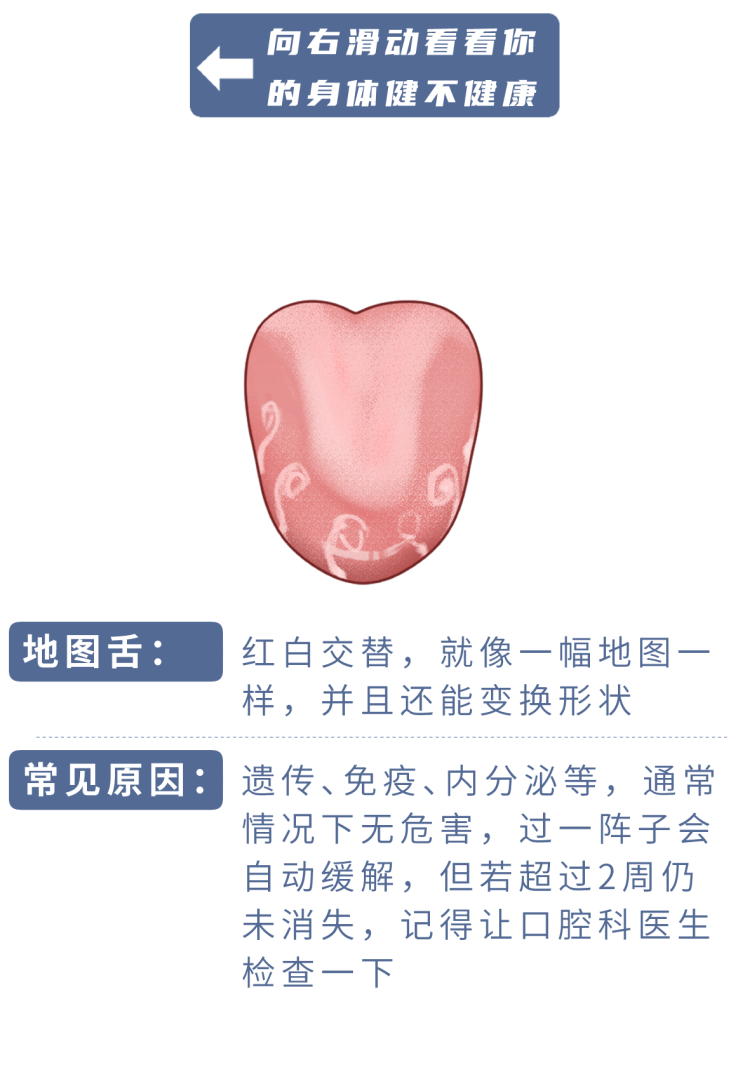 身体好不好，看舌头就知道！若舌头出现这6种情况，当心是疾病信号