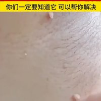 想告诉全世界！这样对脖子小肉粒、眼部脂肪粒很猛！