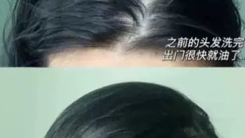 洗发水哪种防脱发效果更好？美丽秀发的完美守护者！