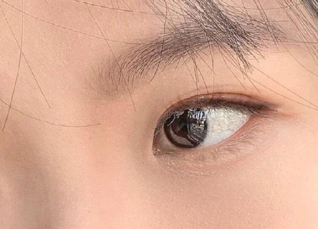 如何挑选合适的隐形眼镜