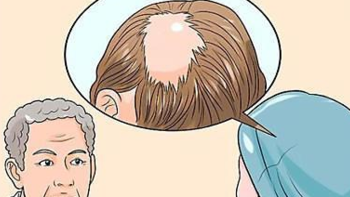 脂溢性脱发怎么防脱？13大护发技巧不容错过