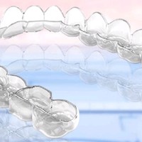 SMILEHERO 隐形牙套牙齿矫正器成人矫治器 龅牙嘴凸地包天牙齿正畸口腔 旗舰版 首期单上牙 