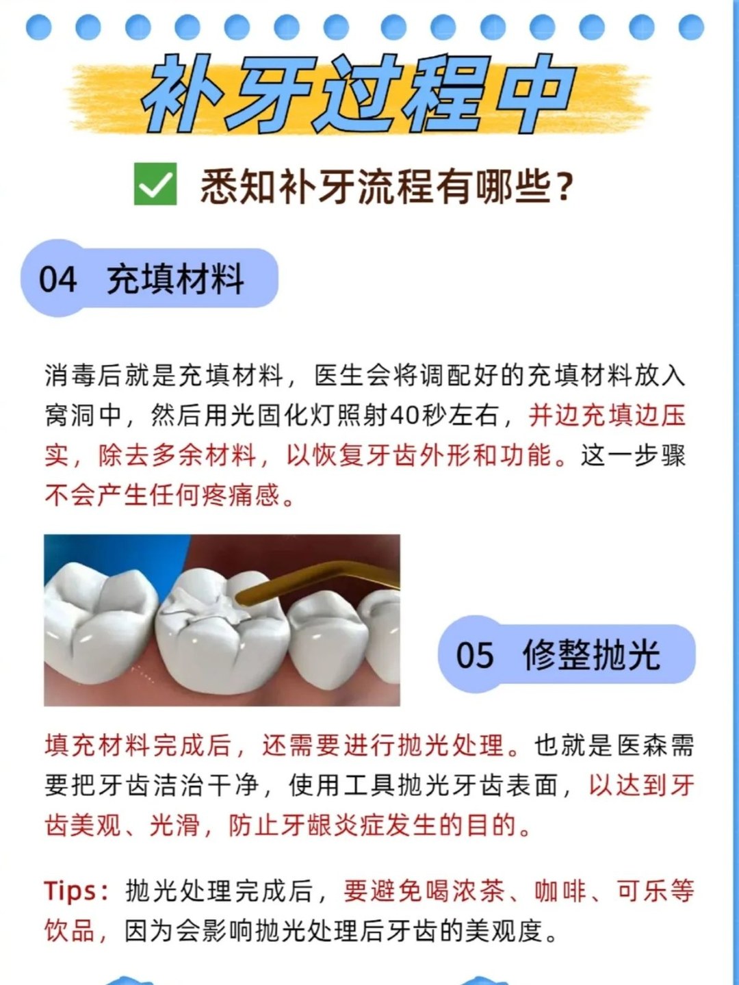 补牙的流程及步骤图片图片