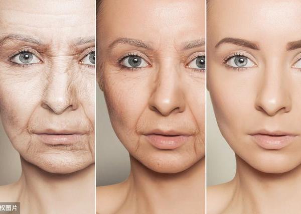 有了法令纹，到底该填充还是提拉？