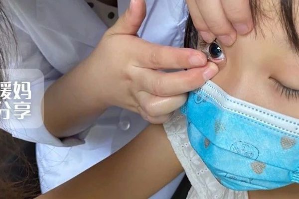 暖暖近视报告 | 8岁确诊真性近视150度以后，我都做了些什么？