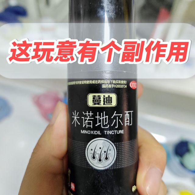 关于米诺地尔的真实使用体验，确实有副作用，但不是你想的那个！