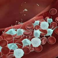 血液粘稠易得血栓！有什么简易方法可以去干预稀释？