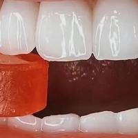 牙医整理牙黄忌口清单汇总！28天亮白牙齿，快收藏！