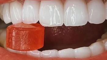 牙医整理牙黄忌口清单汇总！28天亮白牙齿，快收藏！