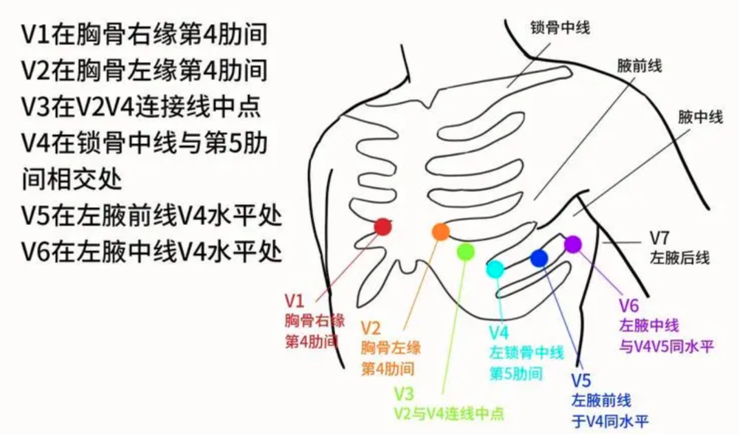 20+因为心脏不适进医院了！奉劝年轻人千万不要再熬夜了