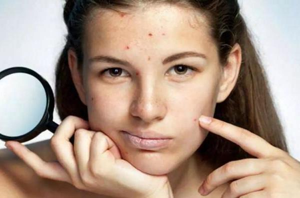 治疗痘坑，怎样效果比较好？