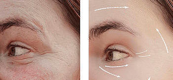 消除皱纹的12个最好最简单方法：护肤博主曝光隐患风险