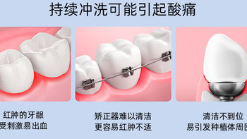 《🦷 笑出强大！这款冲牙器让你的牙齿亮白如新，告别尴尬黄牙！》