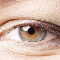 眼角纹怎么去除最有效果？精准避雷14种陷阱风险