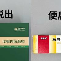 痔疮膏怎么选？痔疮肉球掉出来怎么办？