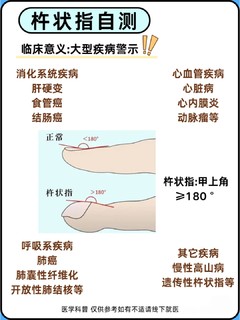 杵状指是心脏在求救，自查一下