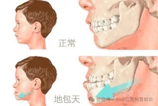 矫正科普：别再问20、30、40岁能不能整牙了，看完这篇就明白！