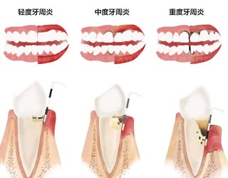 整牙 = 换头？关于牙齿矫正 4 大问题，一文详解