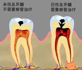 警惕！为什么这么多人牙齿有问题？这些毛病不要再犯！