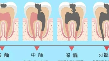 今日刷牙不努力，明日努力刷假牙