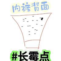 内裤背面长霉点怎么回事?