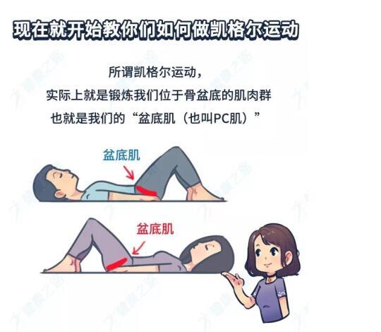 凯格尔运动：女性产后神器，男性健康新帮手！