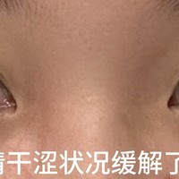 眼镜视力模糊的护理方法，你怎么不等我瞎了再告诉我啊