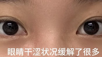 眼镜视力模糊的护理方法，你怎么不等我瞎了再告诉我啊