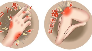 痛风最喜欢的几种习惯，从现在开始都躲着点！