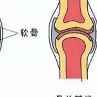 Jarrow氨糖软骨素——为关节健康保驾护航