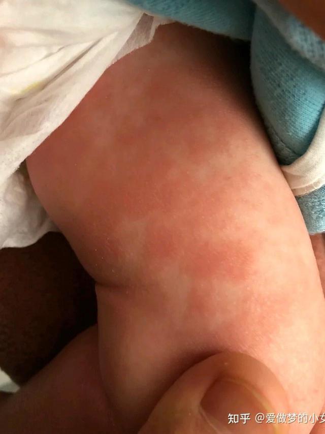 2024宝宝身体乳测评丨老爸评测推荐的Evereden 安唯伊胎脂身体乳是不是智商税？纽强、安唯伊、顺峰宝宝三款大牌婴儿身体乳大PK，一文看懂谁才是婴儿湿痒/泛红/干裂皮肤问题的天选救星！