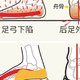 定制矫正鞋科学干预，为运动提供更多可能