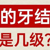 牙结石自测？来看看你的牙结石是几级？怎么去除牙结石！