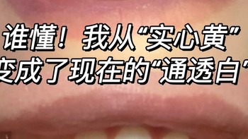 白牙攻略‼️只要几周就能自信笑出来，白牙效果真的好！