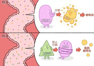 我的减肥神器——舒尔佳®奥利司他胶囊