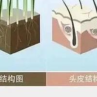 头皮健康影响脱发？蔓迪米诺地尔酊5%黄金浓度为发根注入活力