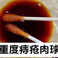 一个对重度痔疮肉球很管用的法子！碘伏对痔疮肉球的威力！