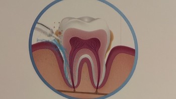 脉冲水流深度清洁专业正确的口腔清洁事半功倍