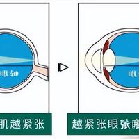 近视不戴眼镜的危害及对策解析