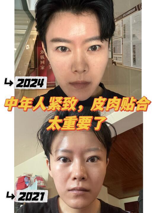 38岁，皮肉贴合的紧致是我的永恒追求