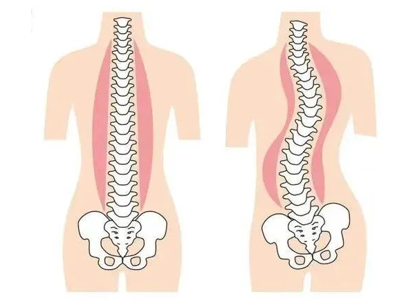 2024年开学季小学生护脊书包推荐！什么样的护脊书包适合小学生？使用护脊书包有什么好处呢？