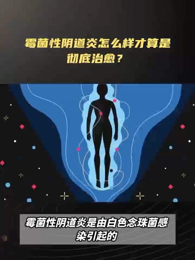 霉菌性妇科炎症，怎么样才能算是彻底治愈了？