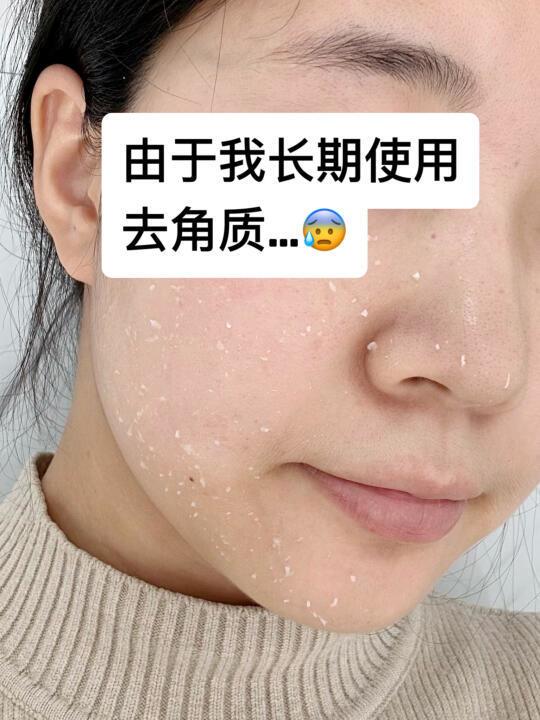 由于我频繁使用去角质...