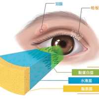 冬季眼睛干是缺水了？普瑞眼科专家：你的眼睛可能缺“油”！