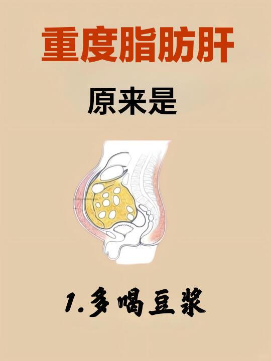 码住！重度肥胖要知道的一些小习惯🔥