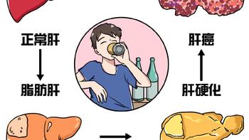 熬夜党的护肝秘籍：饮食调理、运动建议与选择护肝片须知